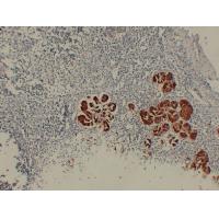 MUC6 Monoclonal Antibody PT0177