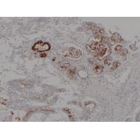 MUC6 Monoclonal Antibody PT0177