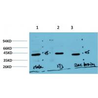 Muscle actin Mouse Monoclonal Antibody3E9