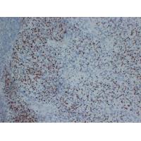 Myogenin Mouse Monoclonal AntibodyPT0193