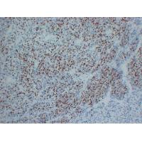 Myogenin Mouse Monoclonal AntibodyPT0193