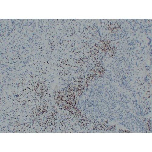 MyoD1 Mouse Monoclonal AntibodyPT0188