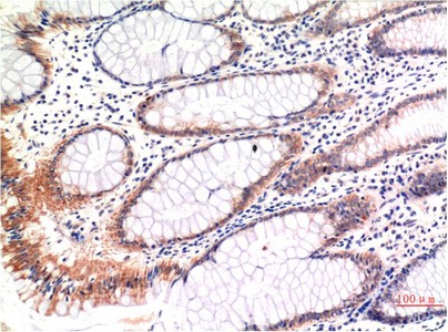 MLKL phospho S358 Mouse Monoclonal Antibody6B4