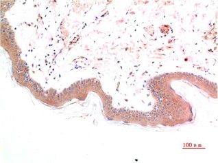 Smad3 phospho Ser425 Mouse Monoclonal Antibody1D9