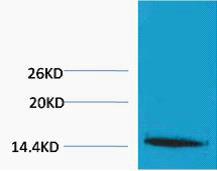 Histone H1 Tri Methyl Lys25 Polyclonal Antibody