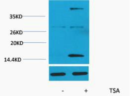 Histone H3 Acetyl Lys4 Polyclonal Antibody