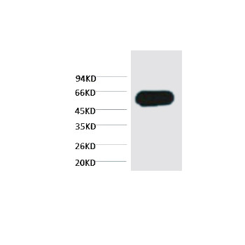 β-tubulin Monoclonal Antibody