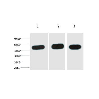 β-tubulin Monoclonal Antibody