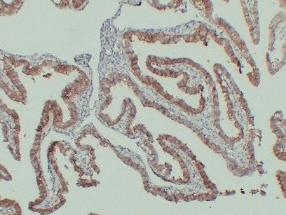 N-cadherin Monoclonal Antibody PT0199