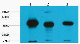 FH Fumarase Monoclonal Antibody2B11