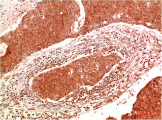 JAK2 Mouse Monoclonal Antibody9B4