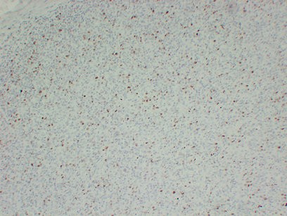 Ki-67 Monoclonal Antibody PT0159