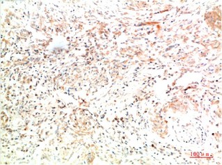 Collagen II Mouse Monoclonal Antibody8F6