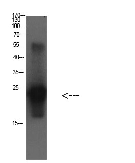 Cystatin C Mouse Monoclonal Antibody3B12