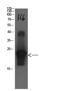 Cystatin C Mouse Monoclonal Antibody3C6