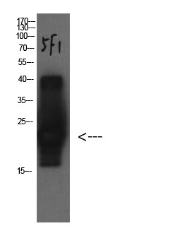 Cystatin C Mouse Monoclonal Antibody5F1