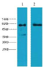 Cytokeratin 6 Monoclonal Antibody4A1