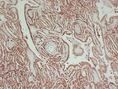 Calretinin Monoclonal Antibody PT0014