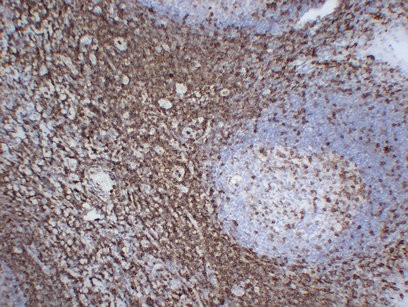 CD43 2B1 mouse Monoclonal Antibody