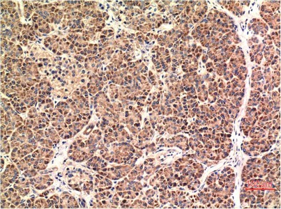 CHOP Mouse Monoclonal Antibody1E1