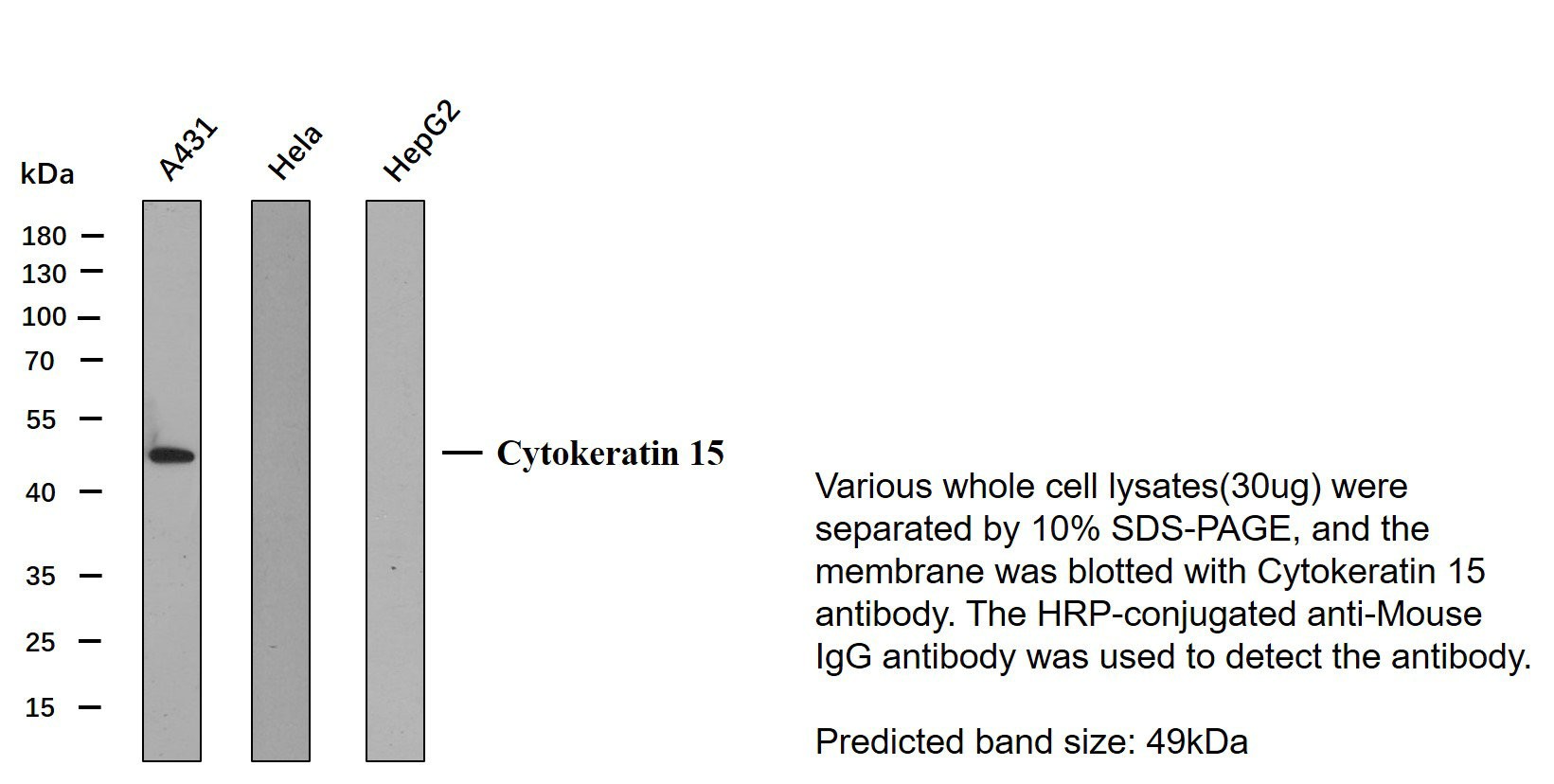 CK-15 5A1 mouse Monoclonal Antibody