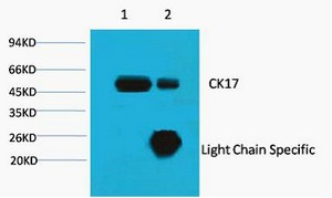 CK-17 Monoclonal Antibody10A1