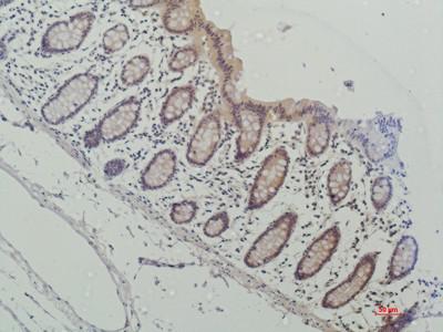 Galectin-3 Monoclonal Antibody16E6