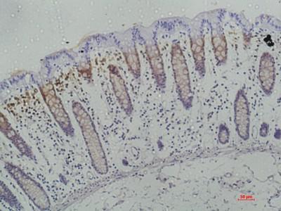 Galectin-3 Monoclonal Antibody1H4