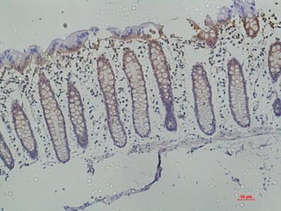 Galectin-3 Monoclonal Antibody6B8