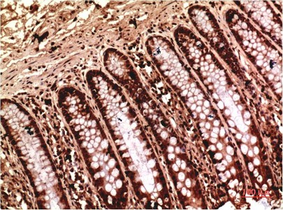 Gamma Tubulin Mouse Monoclonal Antibody7B1