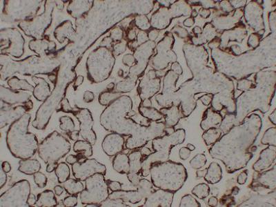 hCG 8G1 mouse Monoclonal Antibody