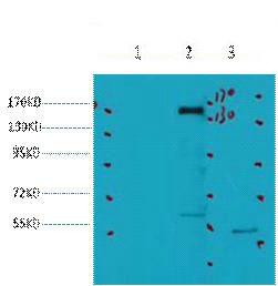 HER2 Monoclonal Antibody3C9