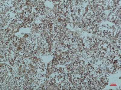 Smad3 Monoclonal Antibody6F7