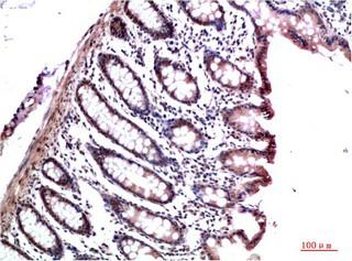 HP1-γ Mouse Monoclonal Antibody4F4