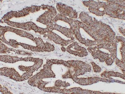 HSP60 9A1 mouse Monoclonal Antibody