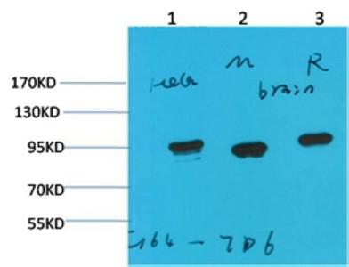 HSP90-α Monoclonal Antibody7D6