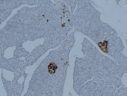 Synaptophysin 2D2 Monoclonal Antibody