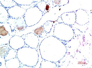 TTR Mouse Monoclonal Antibody10H2