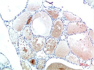 TTR Mouse Monoclonal Antibody2B12