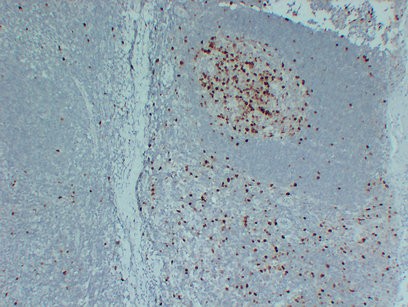 Topoisomerase IIa, CONFIRM Monoclonal Antibody PT0247