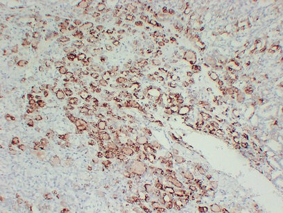 TPO 2G2 mouse Monoclonal Antibody