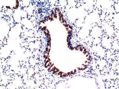 TGFβ1 Mouse Monoclonal Antibody5D2