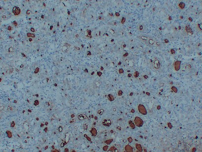 Thyroglobulin Mouse Monoclonal AntibodyPT0245