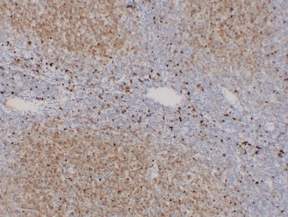 TCL1 Monoclonal Antibody PT0242