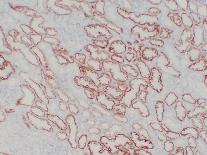 pVHL Mouse Monoclonal AntibodyPT0230