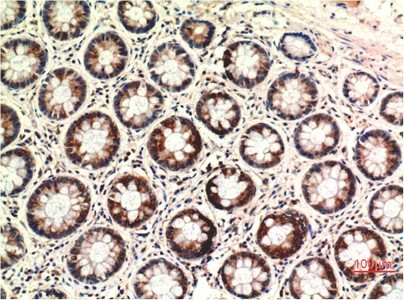 PTEN Mouse Monoclonal Antibody2C10