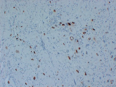 p57kip2 Monoclonal Antibody PT0206