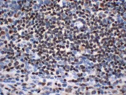 Oct-2 Monoclonal Antibody PT0202