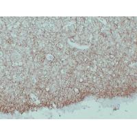 Myelin Basic Protein Monoclonal Antibody PT0183
