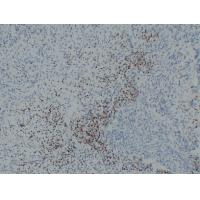 MyoD1 Mouse Monoclonal AntibodyPT0188